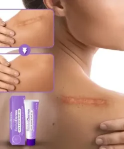 RevivaDerma Face & Body Scar Gel