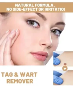 Skin Tag & Mole Remover