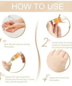 Skin Tag & Mole Remover