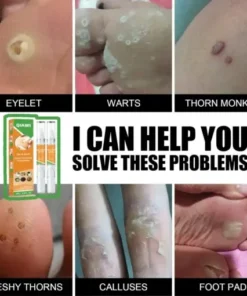 Skin Tag & Mole Remover