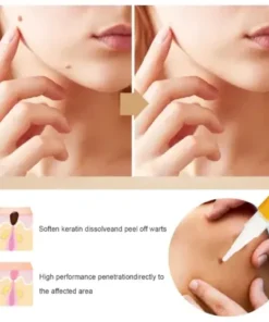 Skin Tag & Mole Remover