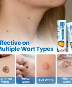 TagGone Wart Removal Cream