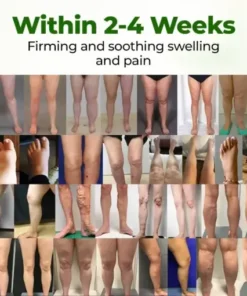 Timilk® Professional Leg Circulation Cream