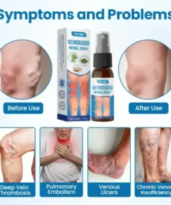 Timilk® VeinGuard Herbal Spray