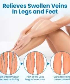 Timilk® VeinGuard Herbal Spray