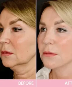 V-Face Lifting Invisible Adhesive Tape