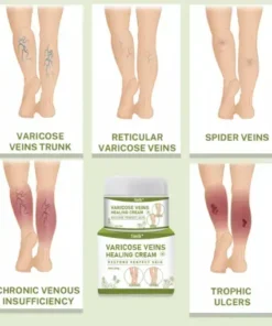 Varicose Veins Healing Cream