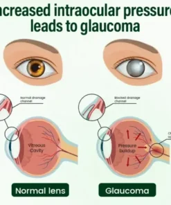 VisionClear Nano Eye Drops