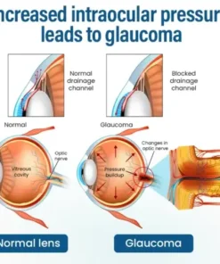 VisionReborn Nano Eye Drops