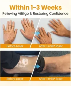 VitiGone Rapid Spray