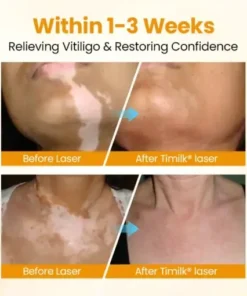 VitiGone Rapid Spray