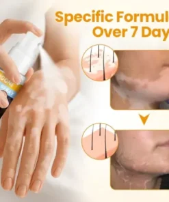 VitiGone Rapid Spray