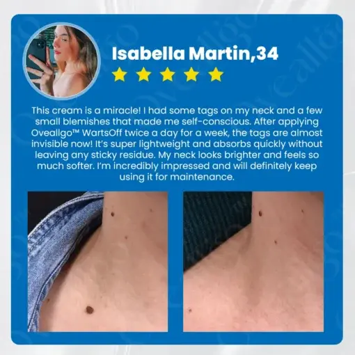 WartsOff Instant Blemish Removal Cream