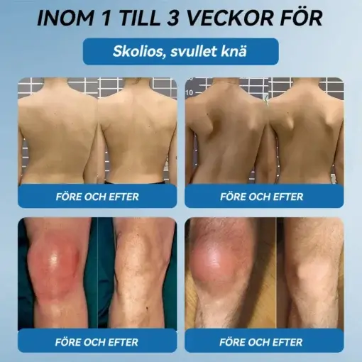 đŻđđŒđ±đŒÂź BPC-157 LedhĂ€lsande krĂ€m