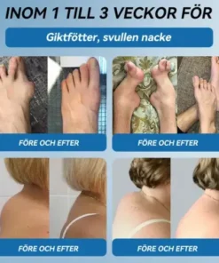 đŻđđŒđ±đŒÂź BPC-157 LedhĂ€lsande krĂ€m