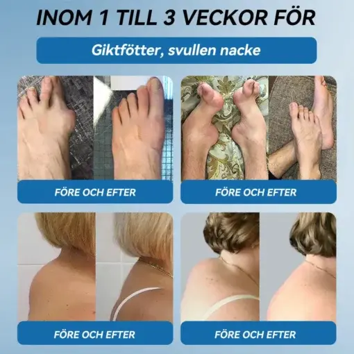 đŻđđŒđ±đŒÂź BPC-157 LedhĂ€lsande krĂ€m