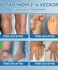 đŻđđŒđ±đŒÂź BPC-157 LedhĂ€lsande krĂ€m