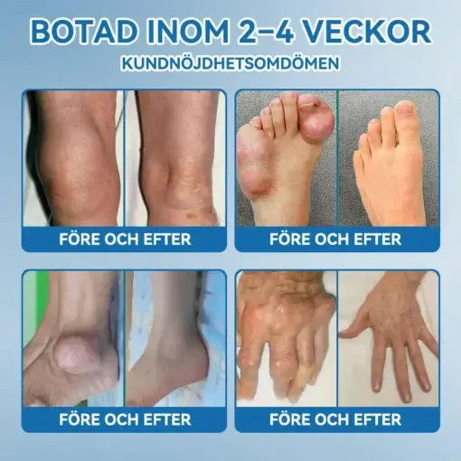 đŻđđŒđ±đŒÂź BPC-157 LedhĂ€lsande krĂ€m