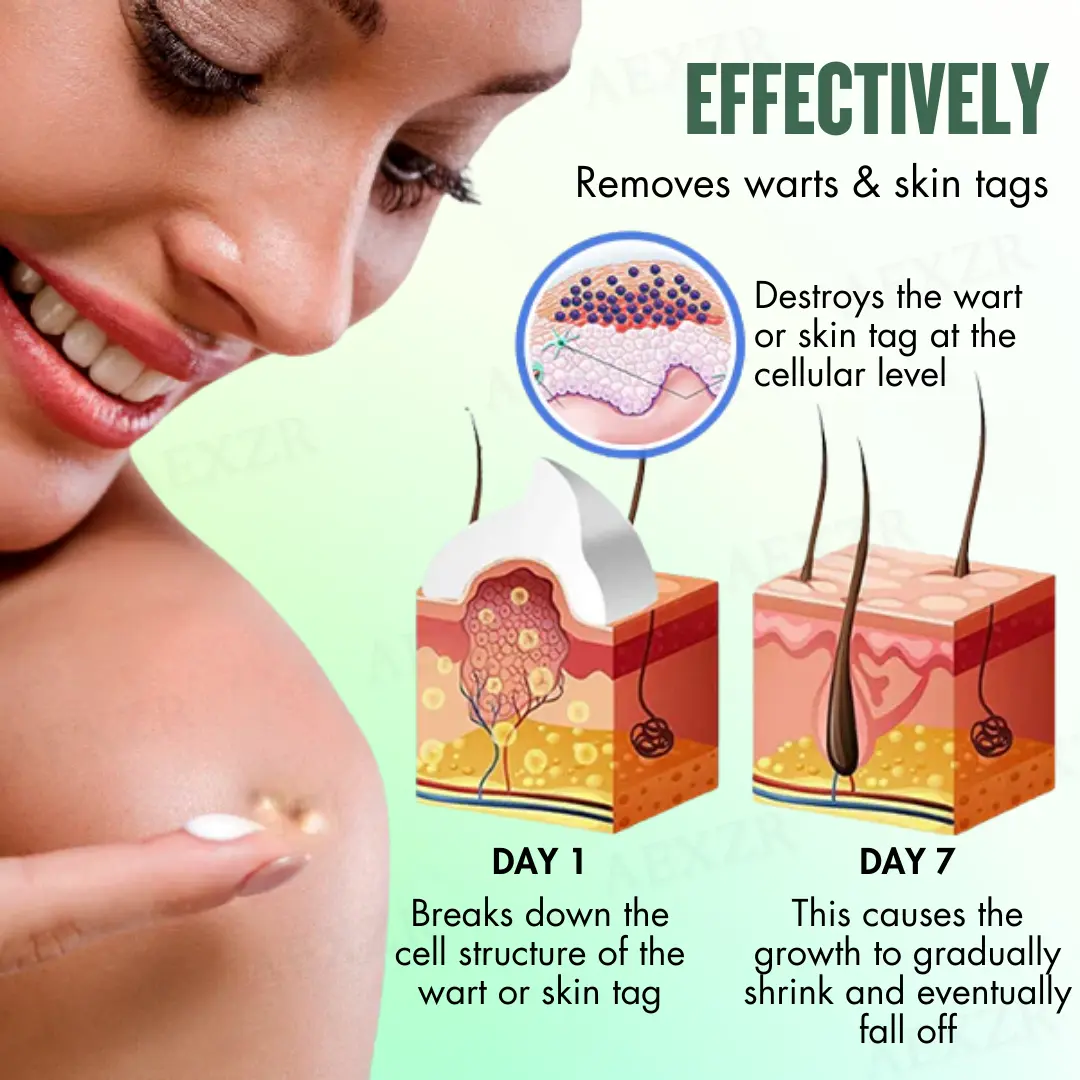 WartsOff Instant Blemish Removal Cream - Image 4