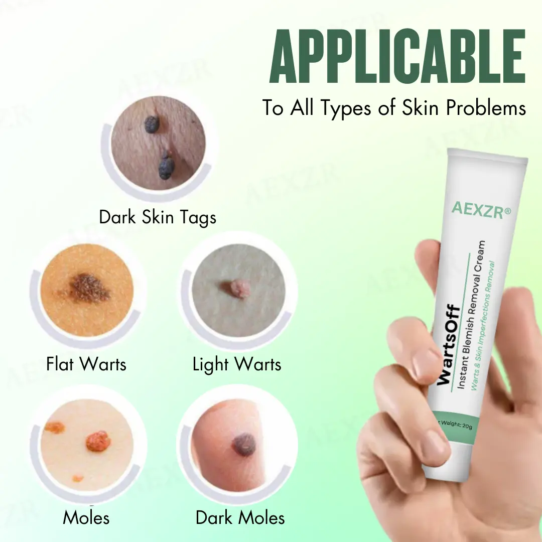WartsOff Instant Blemish Removal Cream - Image 5