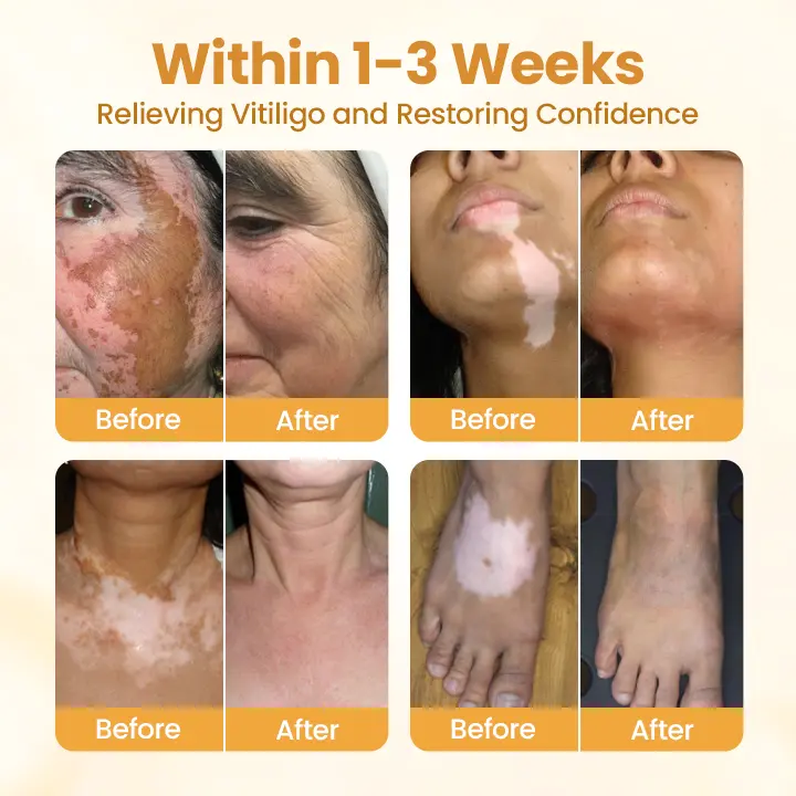 VitiClear Pro Bee Toxin Cream - Image 3