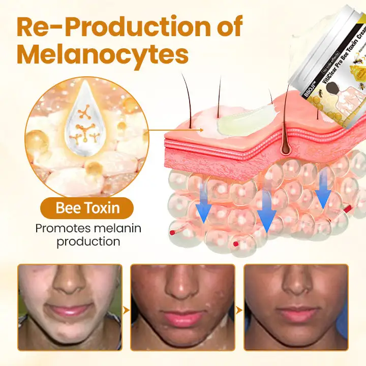 VitiClear Pro Bee Toxin Cream - Image 4