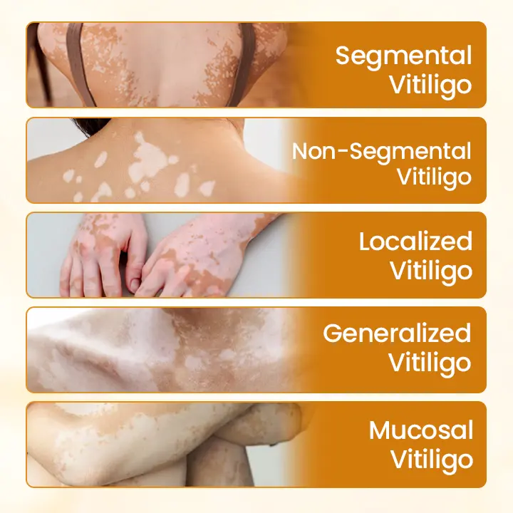 VitiClear Pro Bee Toxin Cream - Image 7