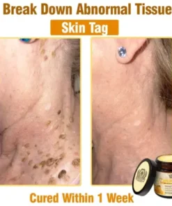 Bee Essence Skin Antibacterial Cream