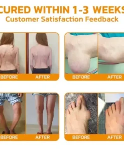 Bee Venom Joint Repair Cream