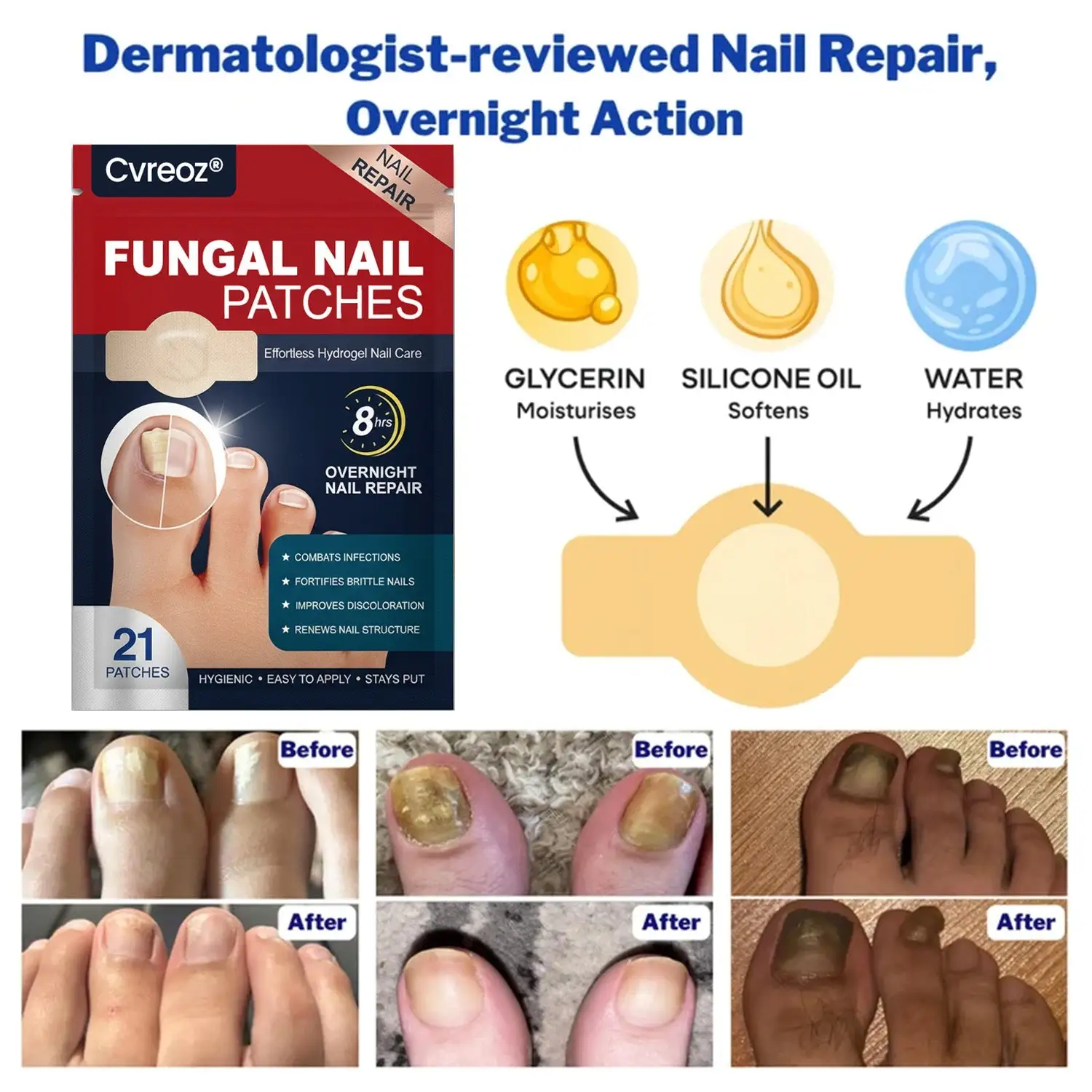 - Fungal Nail Patches - Image 3
