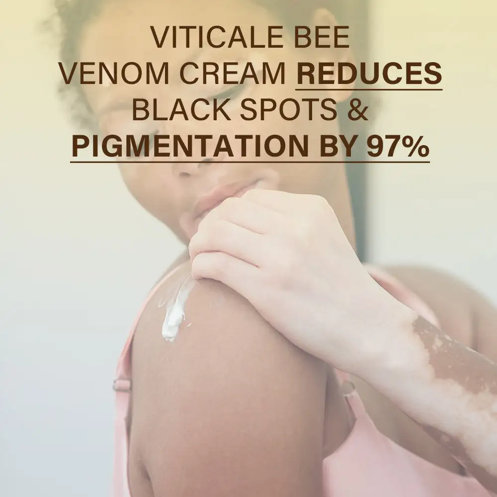VitiClear Bee Venom Cream - Image 3
