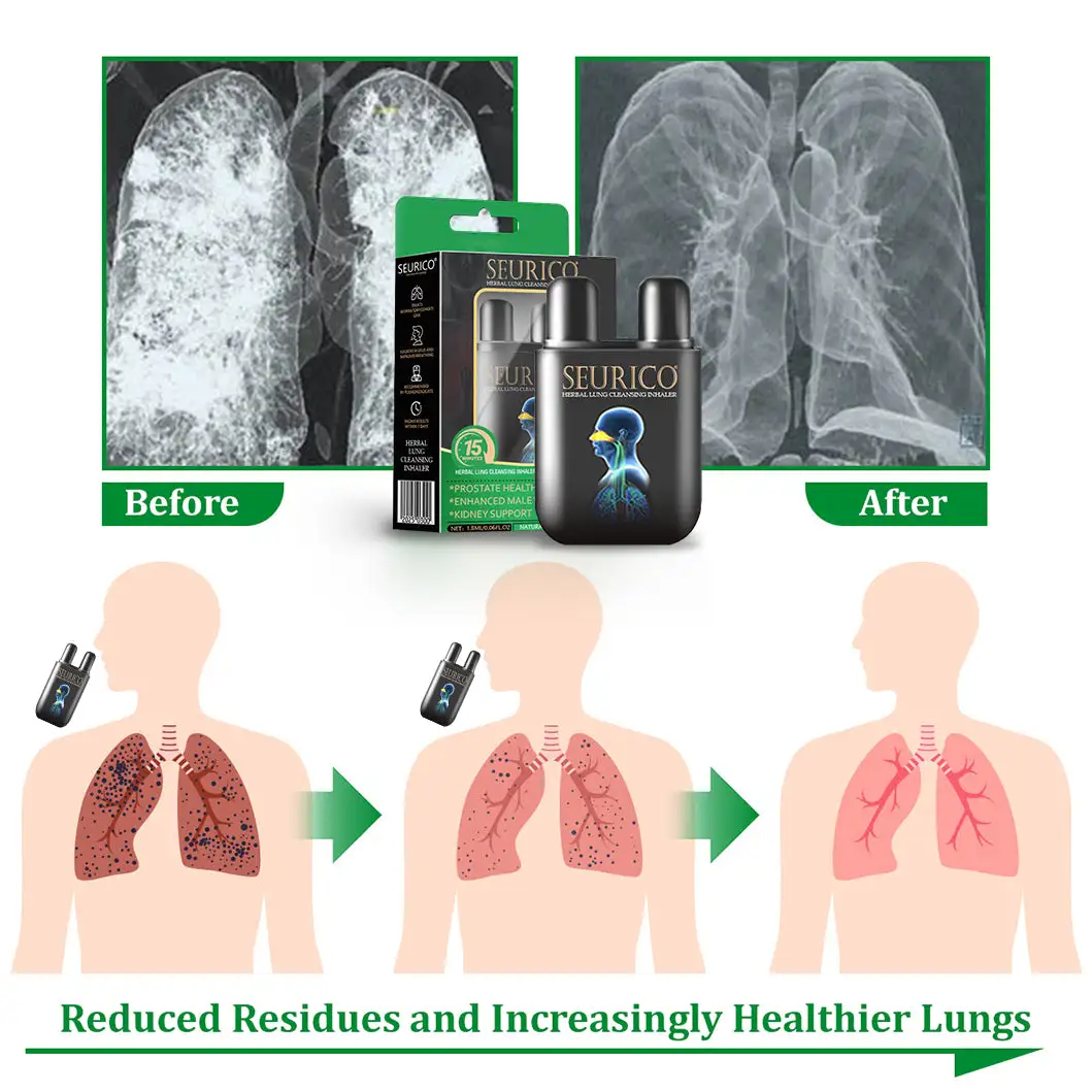 Herbal Lung Cleansing Inhaler - Image 11