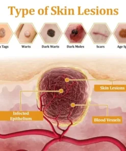 TagCure Bee Venom Cream