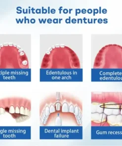 ThermoSeal Fresh Denture
