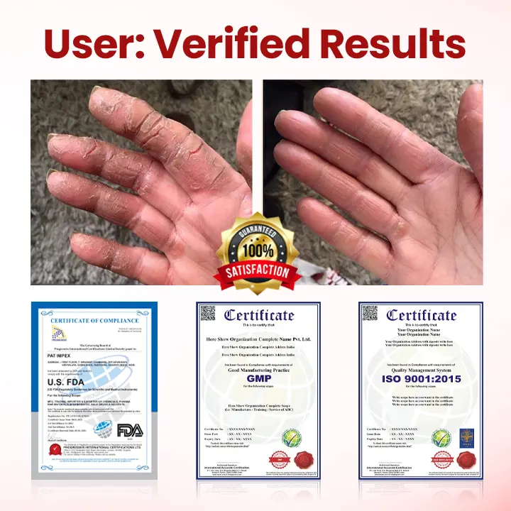 VitaGluco Diabetic Care Cream - Image 3