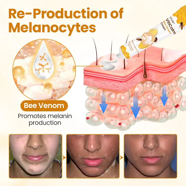 VitiCalm Bee Venom Cream - Image 2