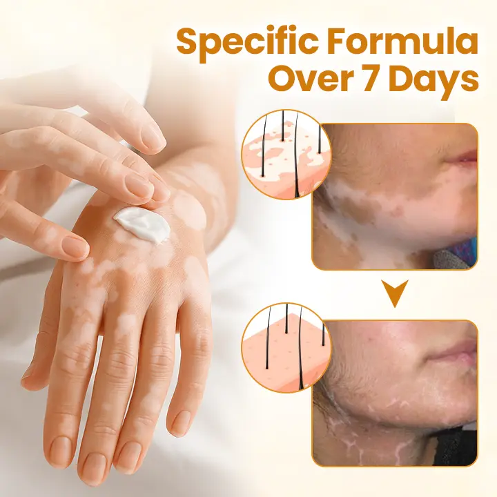 VitiCalm Bee Venom Cream - Image 3