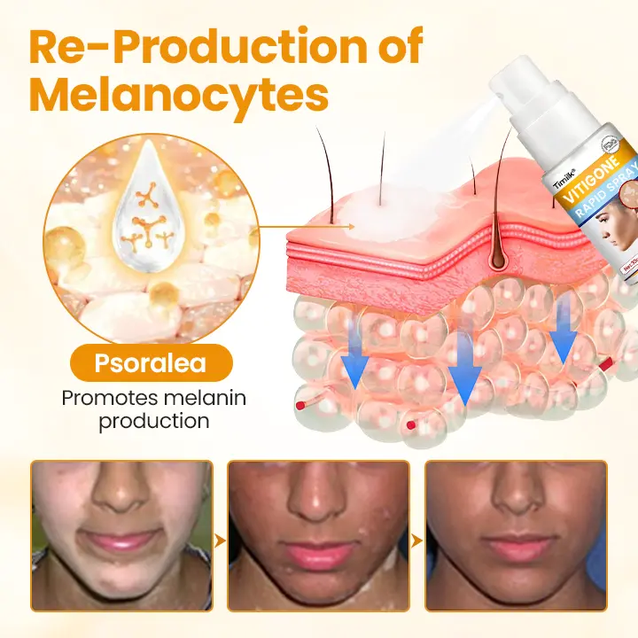 VitiGone Rapid Spray - Image 8