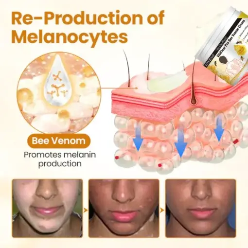 VitiClear Pro Bee Venom Cream