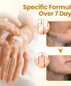 VitiClear Pro Bee Venom Cream