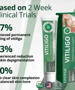 Vitiligo Treatment Cream