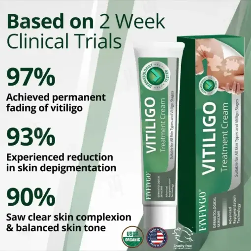 Vitiligo Treatment Cream