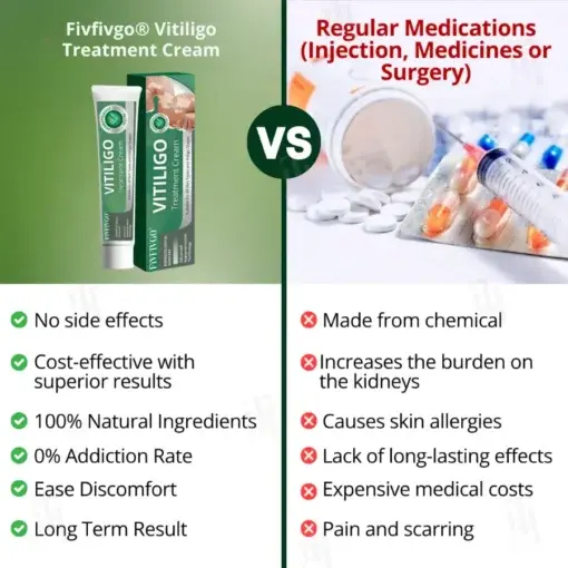Vitiligo Treatment Cream