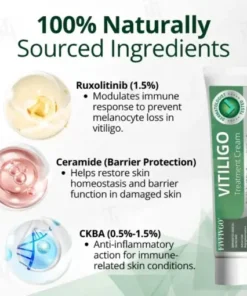 Vitiligo Treatment Cream