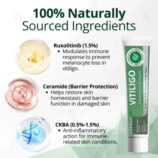 Vitiligo Treatment Cream