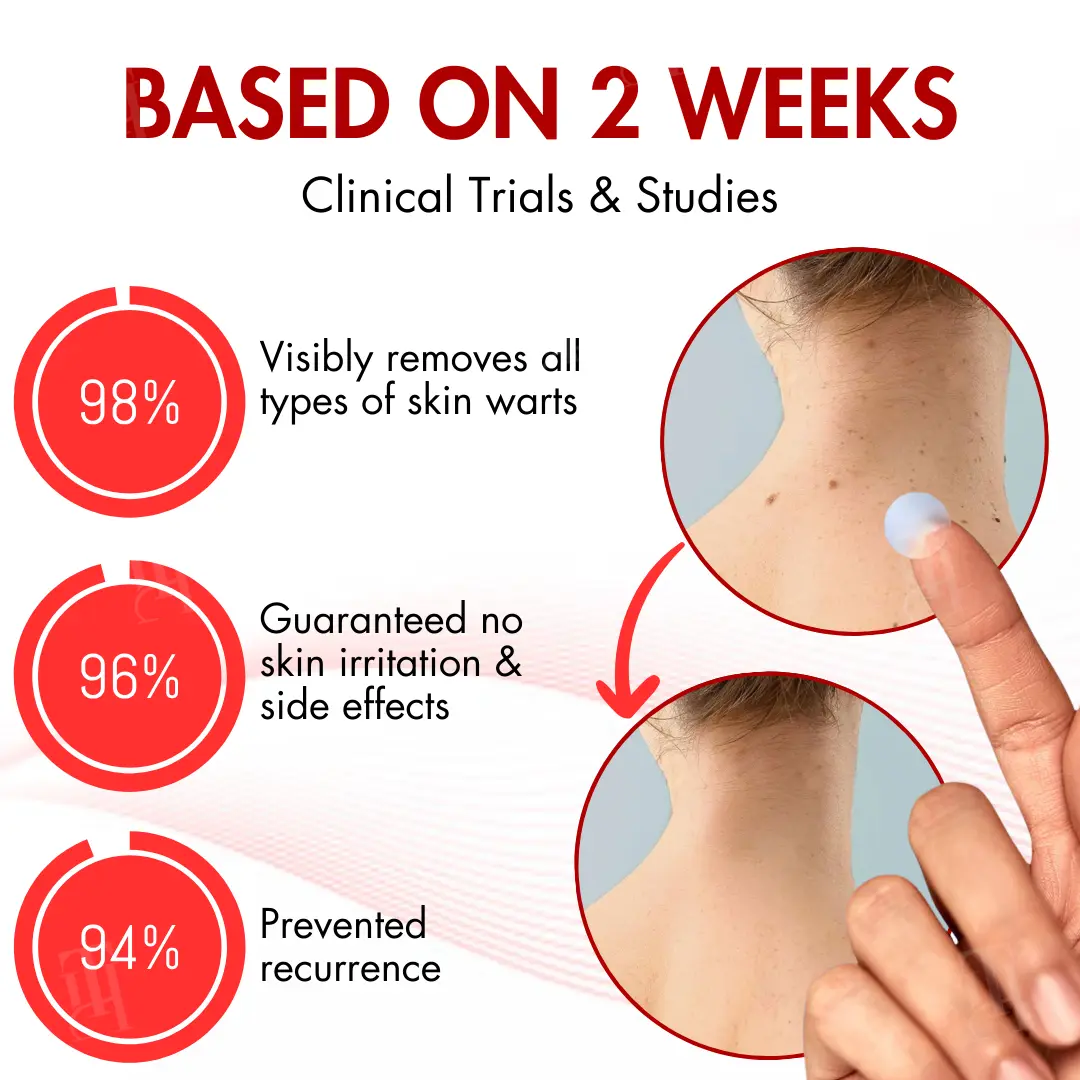 Nano-Microdart Skin Tag & Spot Corrector Patches - Image 3