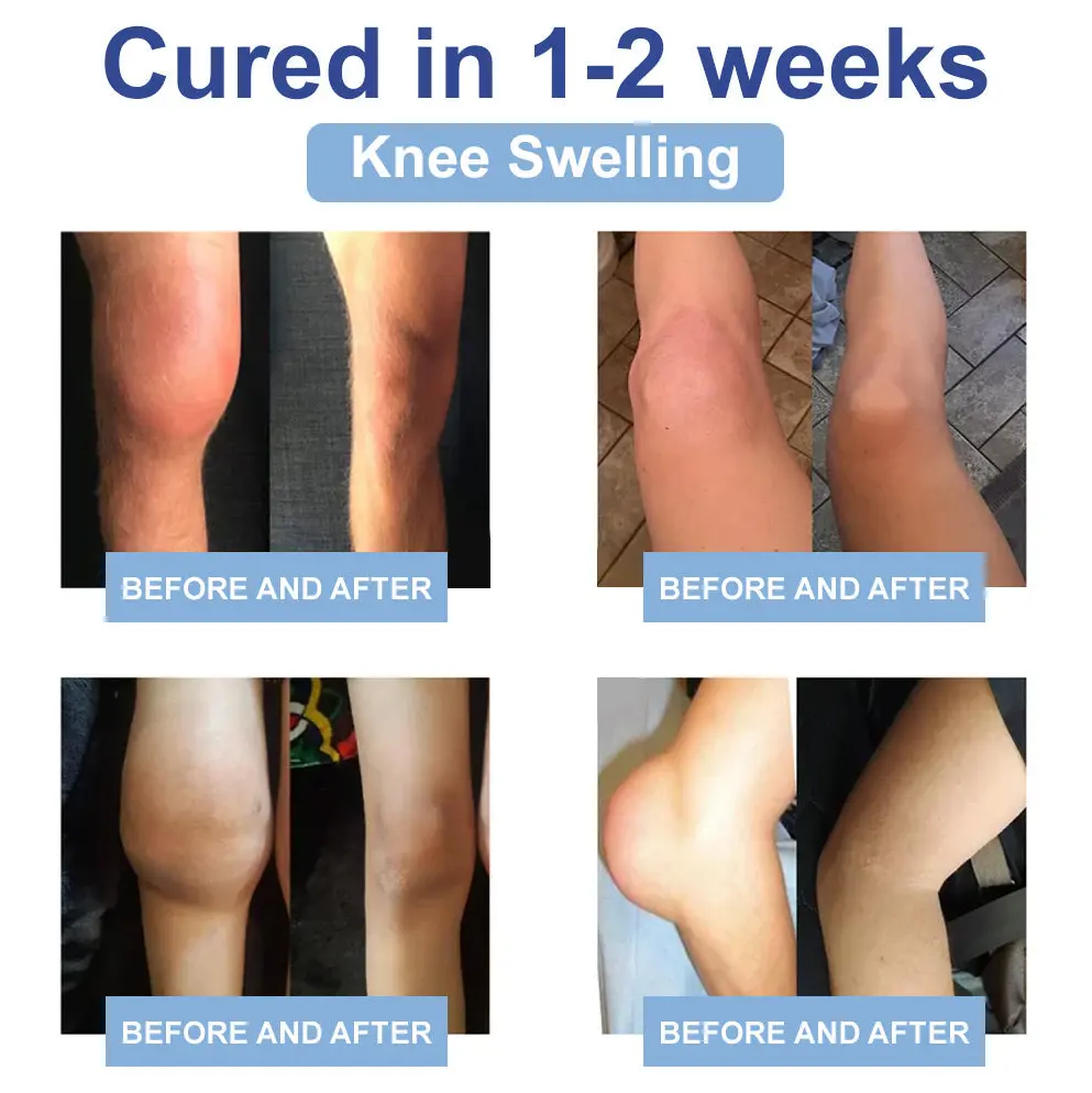 Black Rice Pain Healing Bone Cream - Image 10