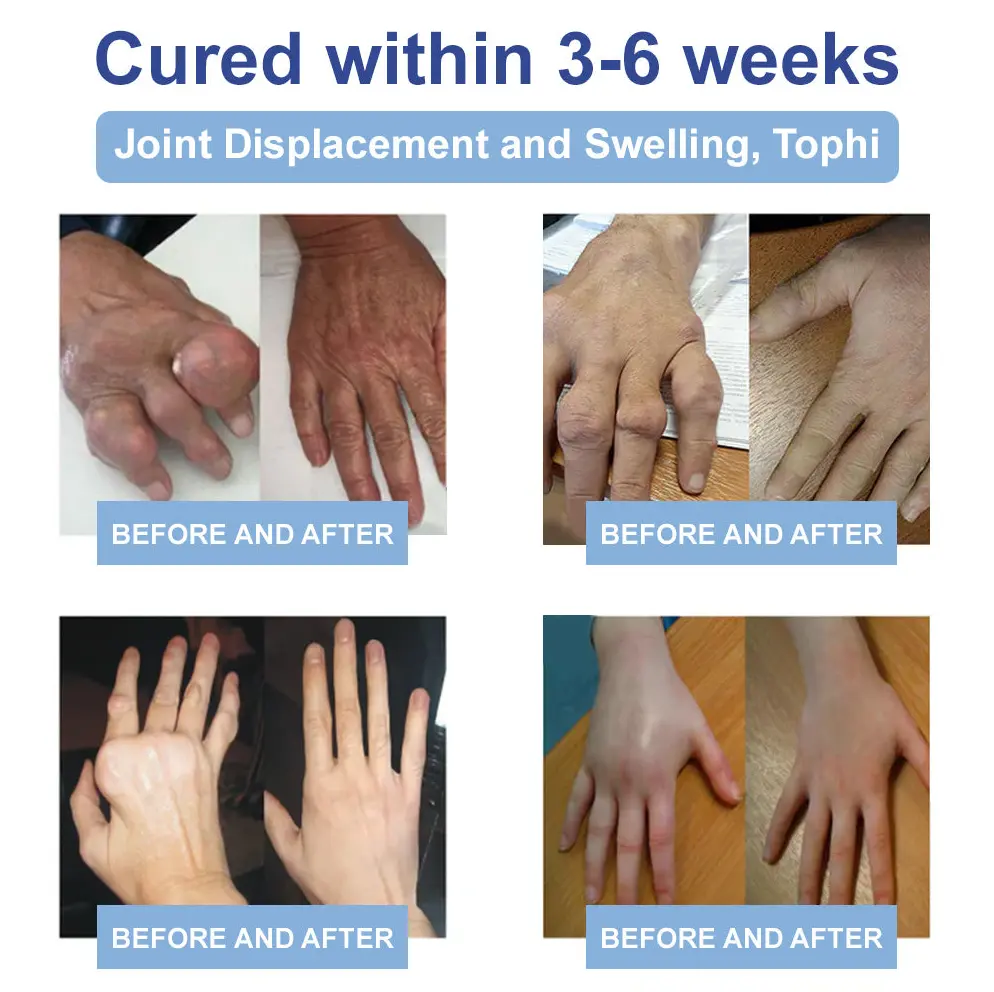 Black Rice Pain Healing Bone Cream - Image 14