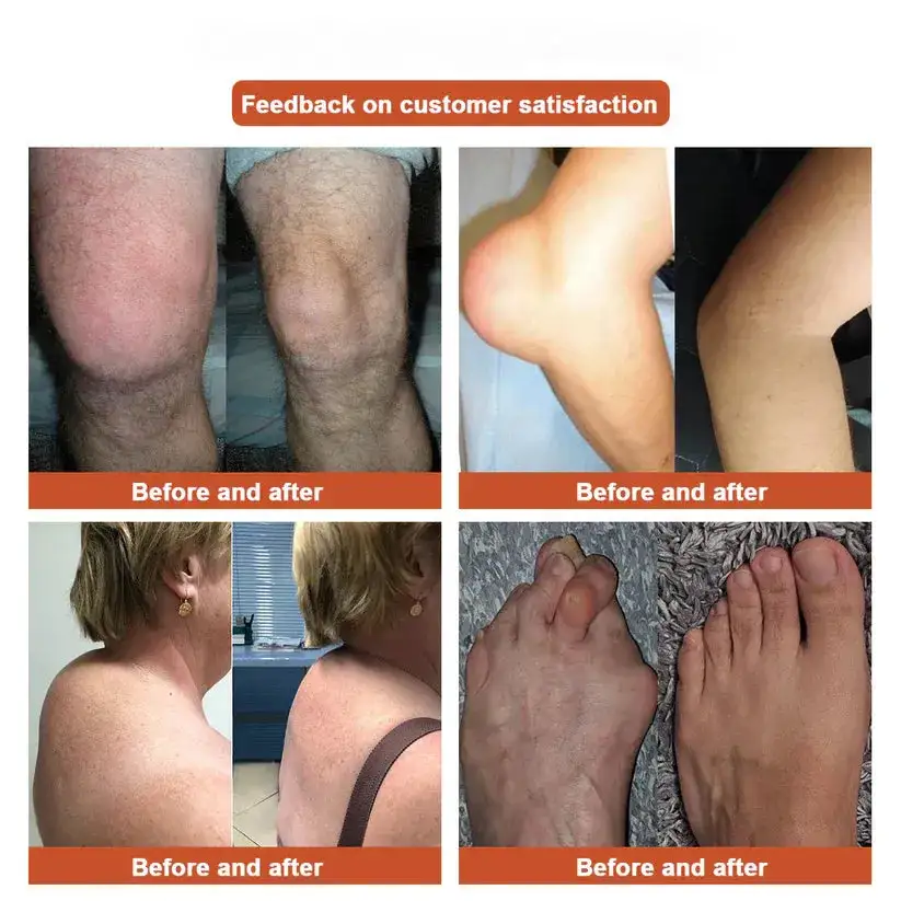 :New upgrade 2.0:Herbal All-in-One Pain Relief Patch - Image 3