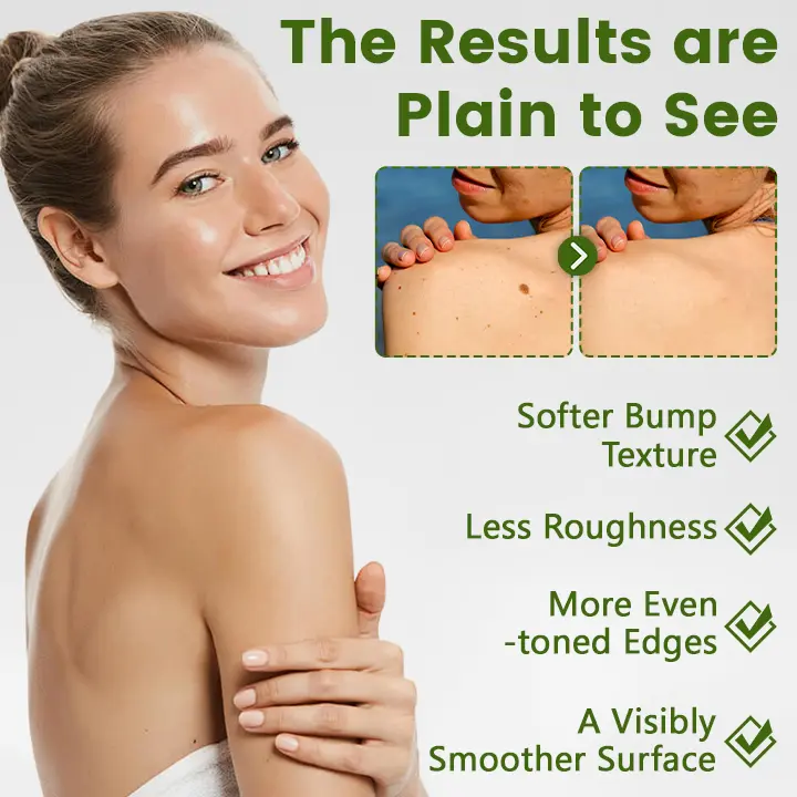 ThujaClear Botanical Wart Cream - Image 4